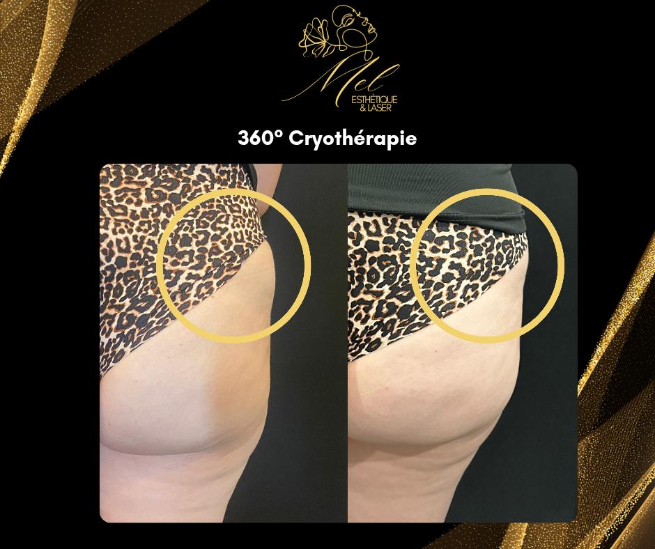 Mel Esthetique & Laser