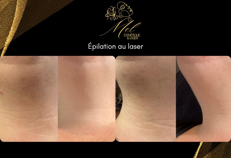 Mel Esthetique & Laser