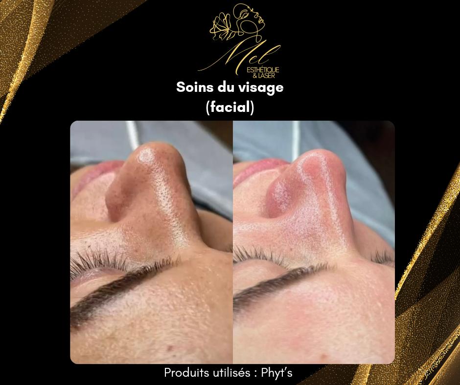 Mel Esthetique & Laser