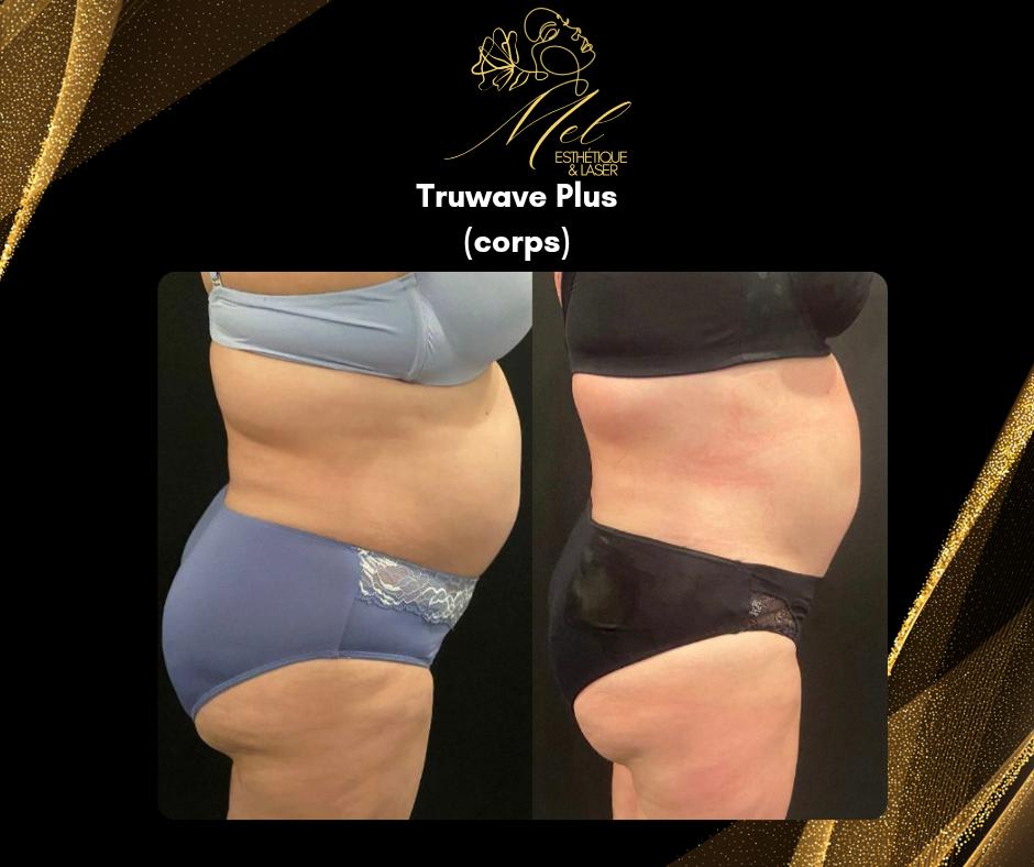 Mel Esthetique & Laser