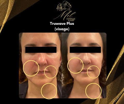 Mel Esthetique & Laser